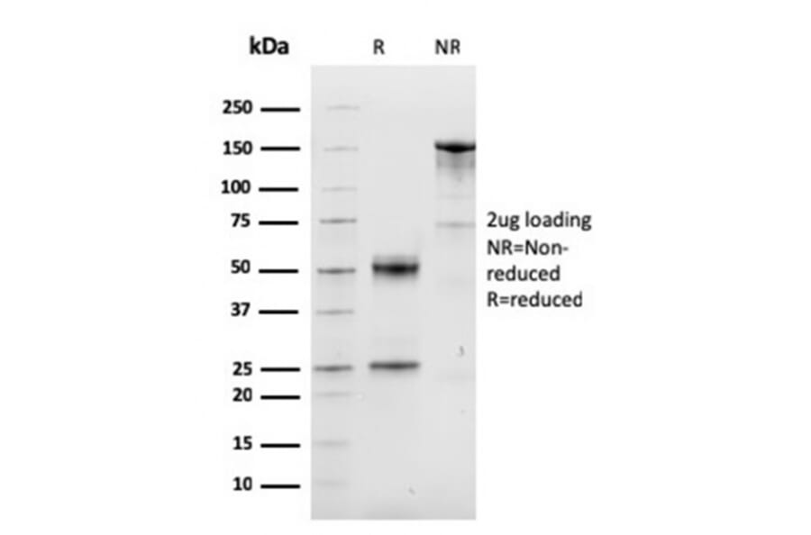 SDS-PAGE - Anti-Cyclin D1 Antibody [CCND1/3548] (CF®594) (A354382) - Antibodies.com