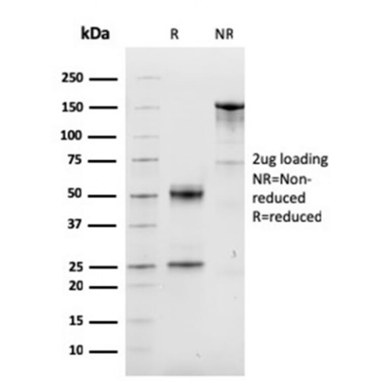 SDS-PAGE - Anti-Cyclin D1 Antibody [CCND1/3548] (CF®594) (A354382) - Antibodies.com