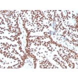 Immunohistochemistry (formalin-fixed, paraffin-embedded) - Anti-Estrogen Receptor alpha Antibody [ESR1/3556] (CF®488A) (A354389) - Antibodies.com