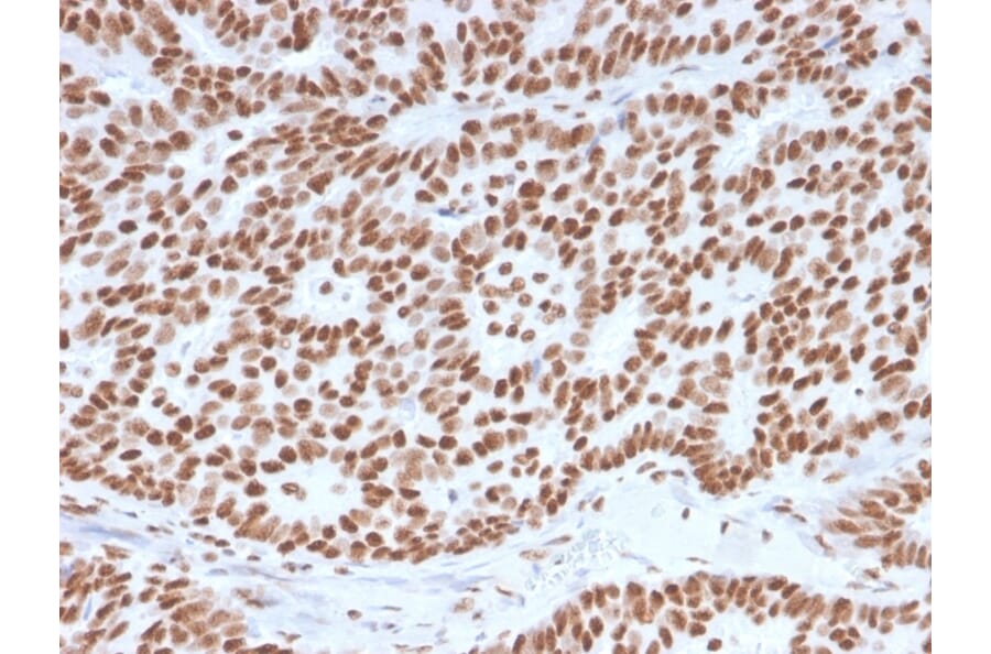 Immunohistochemistry (formalin-fixed, paraffin-embedded) - Anti-Estrogen Receptor alpha Antibody [ESR1/3557] (CF®488A) (A354397) - Antibodies.com