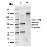 SDS-PAGE - Anti-Estrogen Receptor alpha Antibody [ESR1/3559] (CF®405S) (A354400) - Antibodies.com