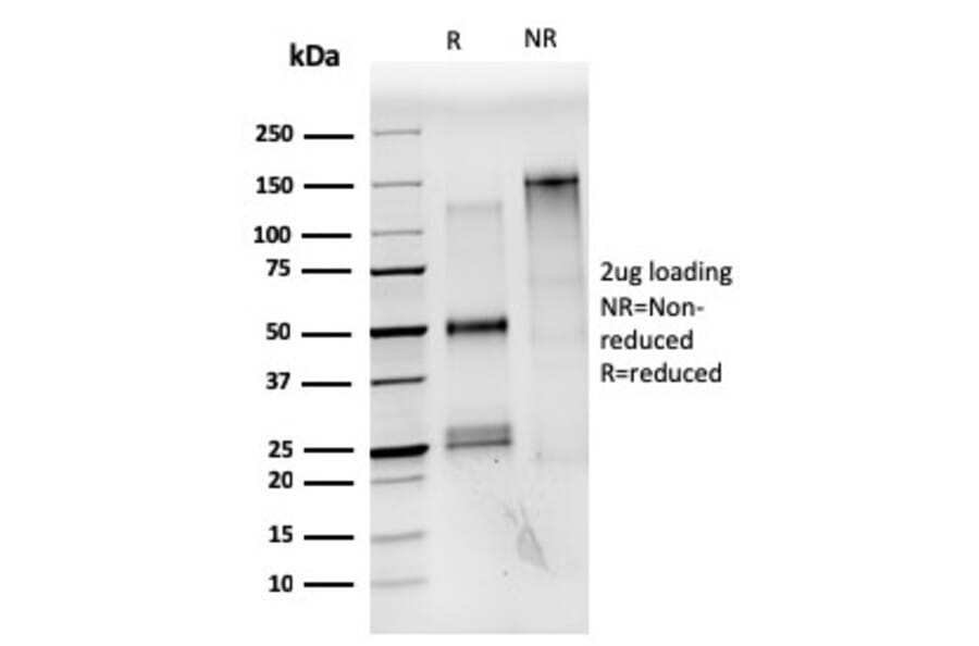 SDS-PAGE - Anti-Estrogen Receptor alpha Antibody [ESR1/3559] (CF®647) (A354402) - Antibodies.com