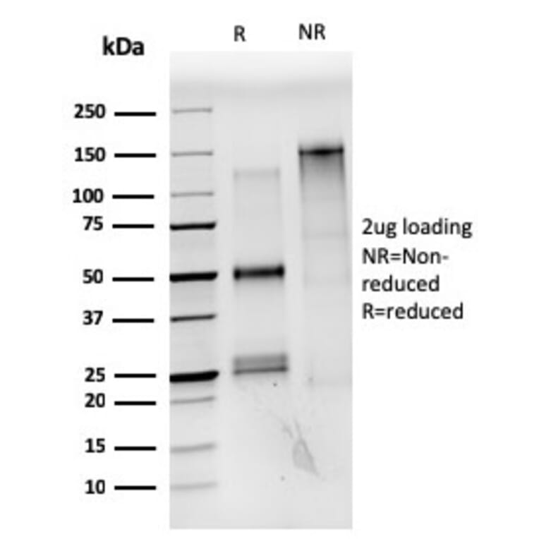 SDS-PAGE - Anti-Estrogen Receptor alpha Antibody [ESR1/3559] (CF®740) (A354404) - Antibodies.com