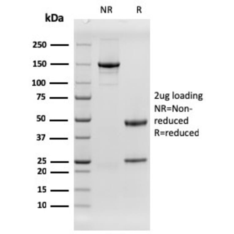 SDS-PAGE - Anti-EGFR Antibody [rGFR/1667] (CF®640R) (A354409) - Antibodies.com