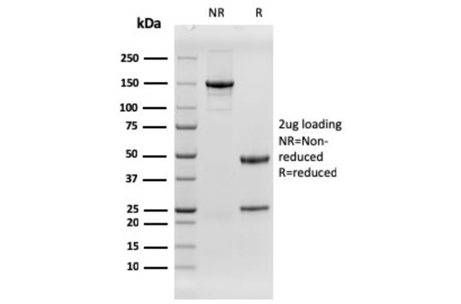 SDS-PAGE - Anti-EGFR Antibody [rGFR/1667] (CF®740) (A354412) - Antibodies.com