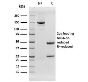 SDS-PAGE - Anti-EGFR Antibody [rGFR/1667] (CF®488A) (A354413) - Antibodies.com