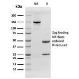 SDS-PAGE - Anti-EGFR Antibody [rGFR/1667] (CF®488A) (A354413) - Antibodies.com