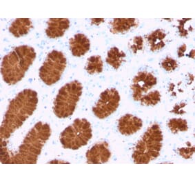 Immunohistochemistry (formalin-fixed, paraffin-embedded) - Anti-MUC5AC Antibody [rMUC5AC/3779] (CF®740) (A354420) - Antibodies.com