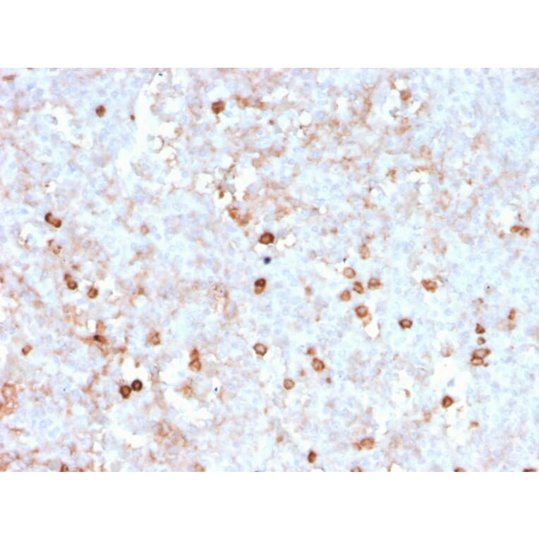 Immunohistochemistry (formalin-fixed, paraffin-embedded) - Anti-CD14 Antibody [rLPSR/2408] (CF®647) (A354426) - Antibodies.com