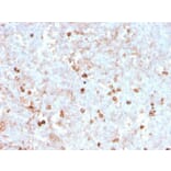 Immunohistochemistry (formalin-fixed, paraffin-embedded) - Anti-CD14 Antibody [rLPSR/2408] (CF®647) (A354426) - Antibodies.com