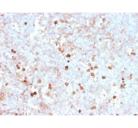 Immunohistochemistry (formalin-fixed, paraffin-embedded) - Anti-CD14 Antibody [rLPSR/2408] (CF®488A) (A354429) - Antibodies.com