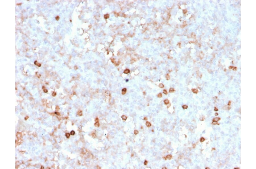 Immunohistochemistry (formalin-fixed, paraffin-embedded) - Anti-CD14 Antibody [rLPSR/2408] (CF®488A) (A354429) - Antibodies.com