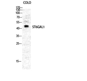 Western blot - CD75 Polyclonal Antibody from Signalway Antibody (40706) - Antibodies.com