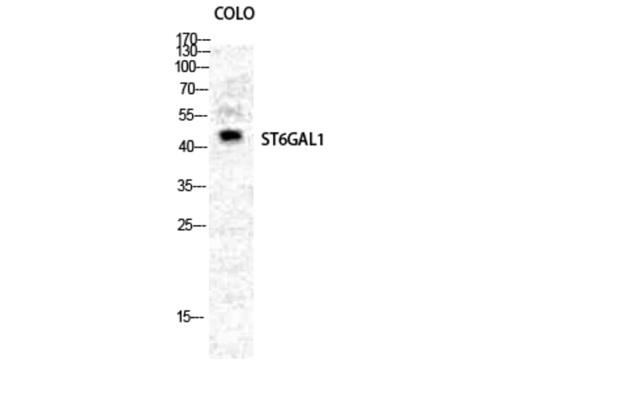 Western blot - CD75 Polyclonal Antibody from Signalway Antibody (40706) - Antibodies.com
