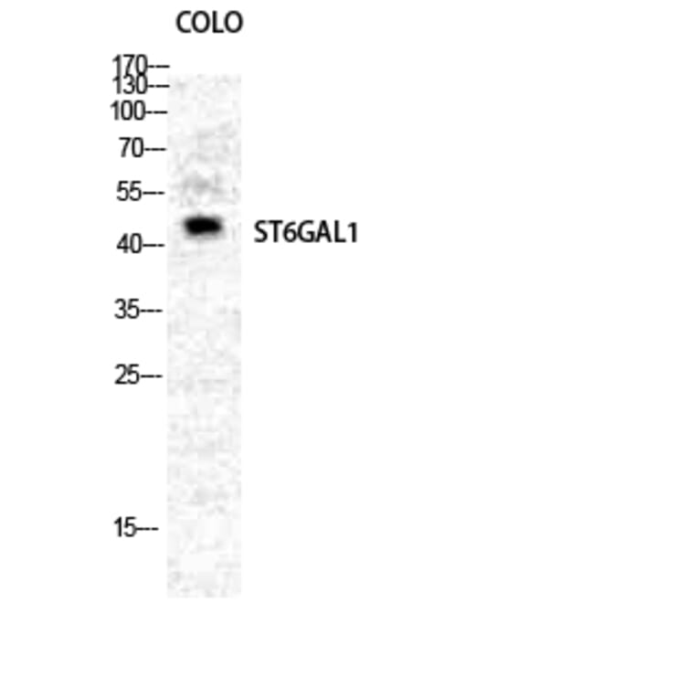 Western blot - CD75 Polyclonal Antibody from Signalway Antibody (40706) - Antibodies.com