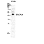 Western blot - CD75 Polyclonal Antibody from Signalway Antibody (40706) - Antibodies.com
