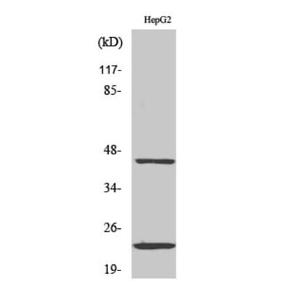 Western blot - CD83 Polyclonal Antibody from Signalway Antibody (40707) - Antibodies.com