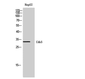 Western blot - Cdk5 Polyclonal Antibody from Signalway Antibody (40721) - Antibodies.com