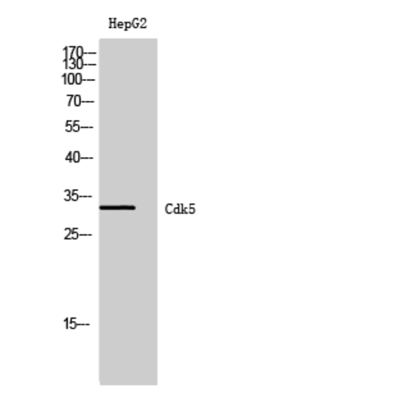 Western blot - Cdk5 Polyclonal Antibody from Signalway Antibody (40721) - Antibodies.com