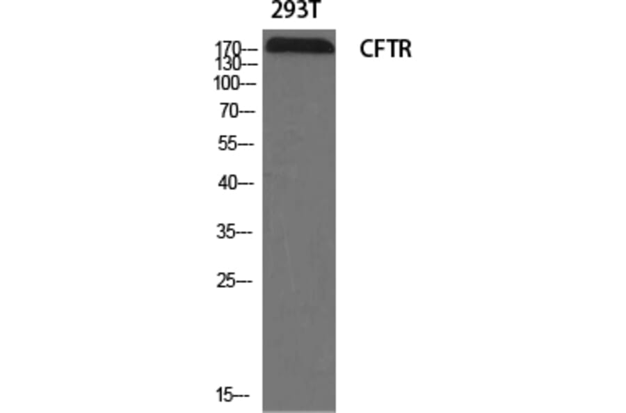 Western blot - CFTR Polyclonal Antibody from Signalway Antibody (40734) - Antibodies.com