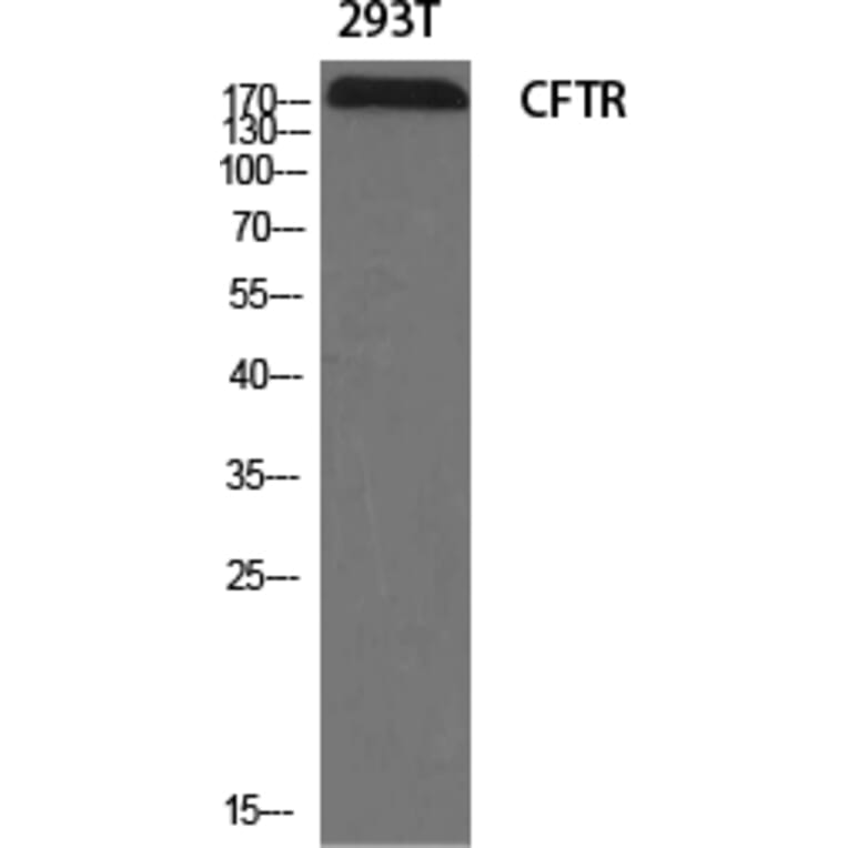 Western blot - CFTR Polyclonal Antibody from Signalway Antibody (40734) - Antibodies.com