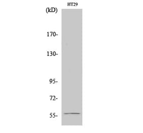 Western blot - Chk1 Polyclonal Antibody from Signalway Antibody (40740) - Antibodies.com