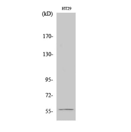 Western blot - Chk1 Polyclonal Antibody from Signalway Antibody (40740) - Antibodies.com