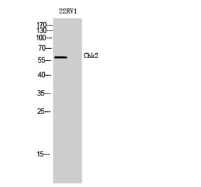 Western blot - Chk2 Polyclonal Antibody from Signalway Antibody (40741) - Antibodies.com