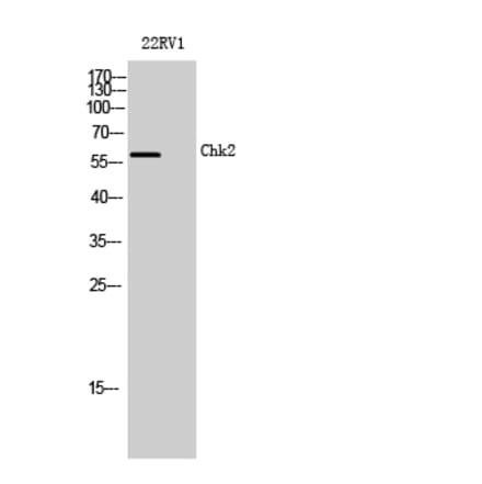 Western blot - Chk2 Polyclonal Antibody from Signalway Antibody (40741) - Antibodies.com