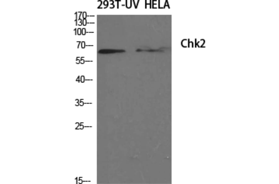 Western blot - Chk2 Polyclonal Antibody from Signalway Antibody (40742) - Antibodies.com