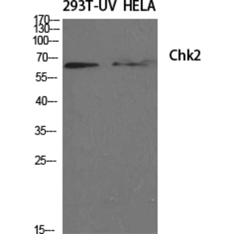 Western blot - Chk2 Polyclonal Antibody from Signalway Antibody (40742) - Antibodies.com