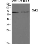 Western blot - Chk2 Polyclonal Antibody from Signalway Antibody (40742) - Antibodies.com