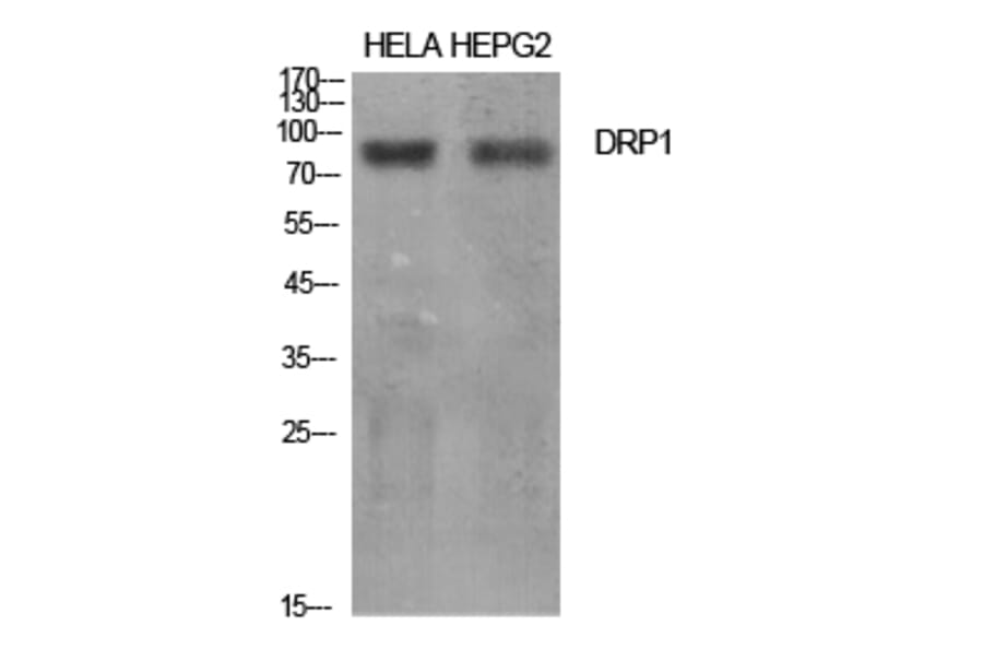Western blot - DRP1 Polyclonal Antibody from Signalway Antibody (40853) - Antibodies.com