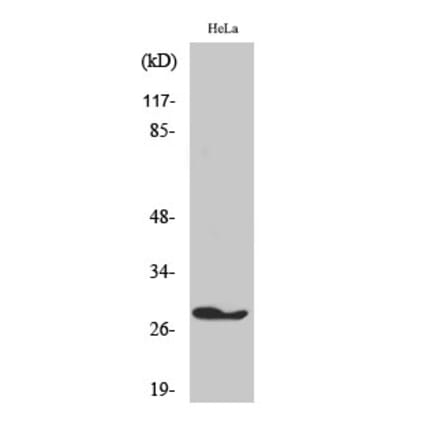 Western blot - FADD Polyclonal Antibody from Signalway Antibody (40912) - Antibodies.com
