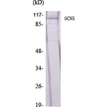 Western blot - GCN5 Polyclonal Antibody from Signalway Antibody (40956) - Antibodies.com