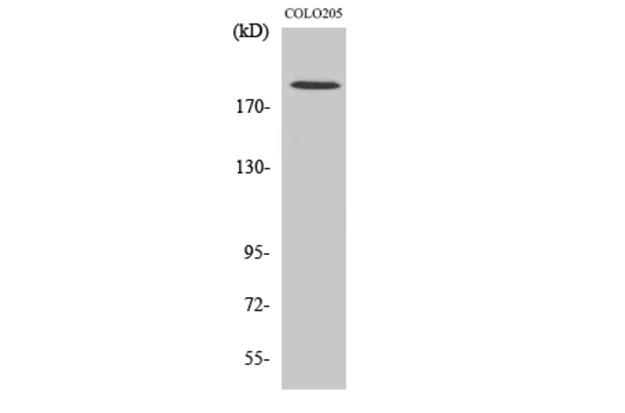 Western blot - GCP6 Polyclonal Antibody from Signalway Antibody (40958) - Antibodies.com
