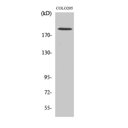 Western blot - GCP6 Polyclonal Antibody from Signalway Antibody (40958) - Antibodies.com