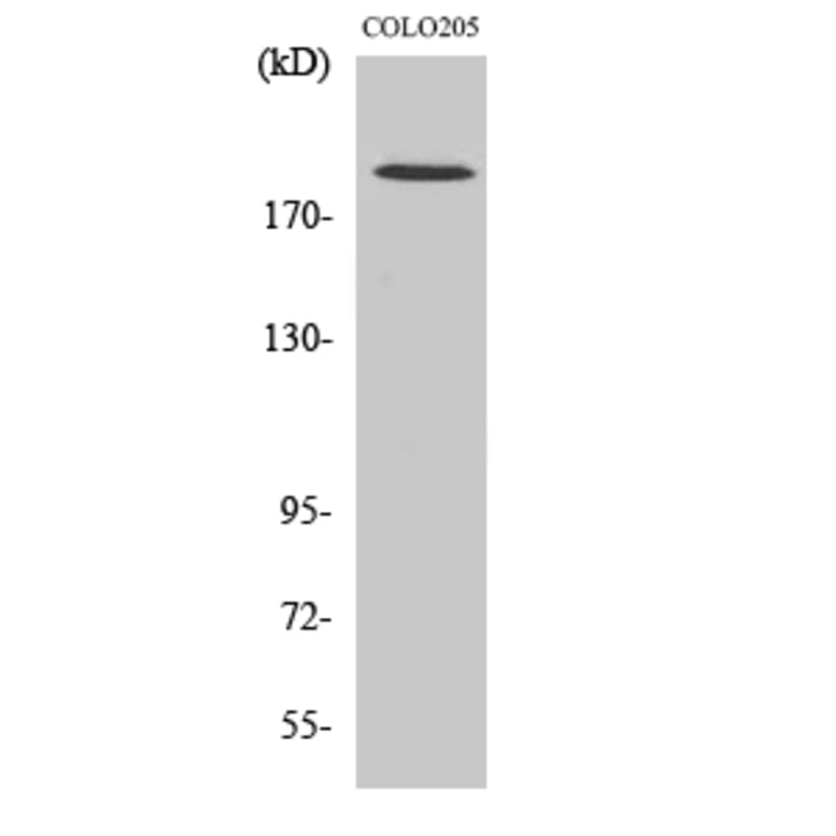 Western blot - GCP6 Polyclonal Antibody from Signalway Antibody (40958) - Antibodies.com
