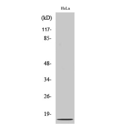 Western blot - IL-8 Polyclonal Antibody from Signalway Antibody (41063) - Antibodies.com