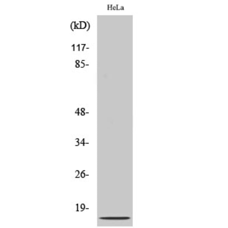 Western blot - IL-8 Polyclonal Antibody from Signalway Antibody (41063) - Antibodies.com