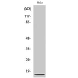 Western blot - IL-8 Polyclonal Antibody from Signalway Antibody (41063) - Antibodies.com