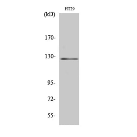 Western blot - JAK2 Polyclonal Antibody from Signalway Antibody (41081) - Antibodies.com