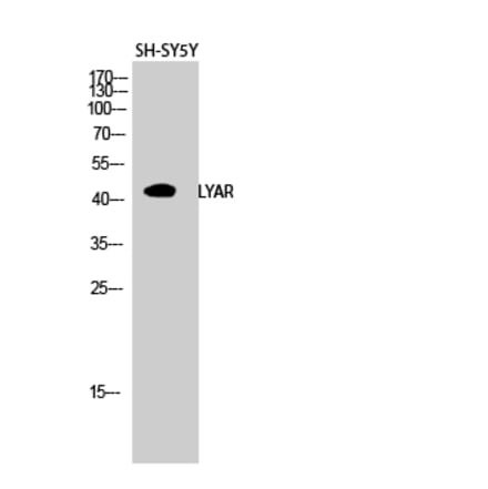 Western blot - LYAR Polyclonal Antibody from Signalway Antibody (41115) - Antibodies.com