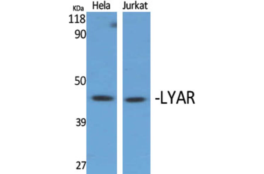 Western blot - LYAR Polyclonal Antibody from Signalway Antibody (41115) - Antibodies.com