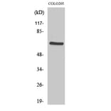 Western blot - PDK1 Polyclonal Antibody from Signalway Antibody (41329) - Antibodies.com