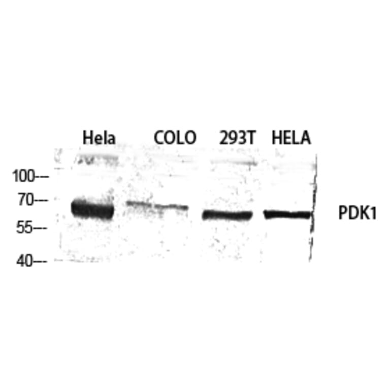 Western blot - PDK1 Polyclonal Antibody from Signalway Antibody (41329) - Antibodies.com