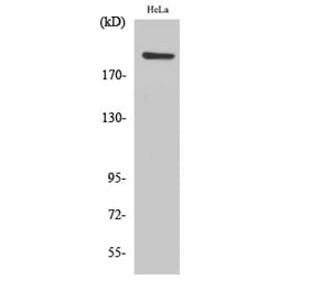 Western blot - PHF3 Polyclonal Antibody from Signalway Antibody (41336) - Antibodies.com