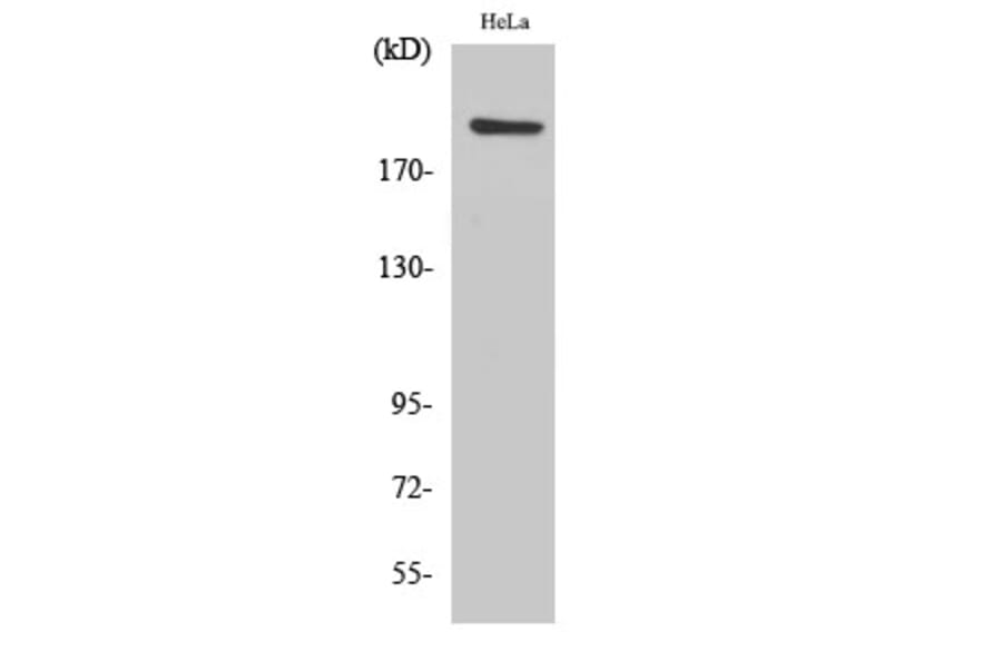 Western blot - PHF3 Polyclonal Antibody from Signalway Antibody (41336) - Antibodies.com