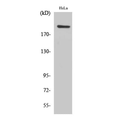 Western blot - PHF3 Polyclonal Antibody from Signalway Antibody (41336) - Antibodies.com