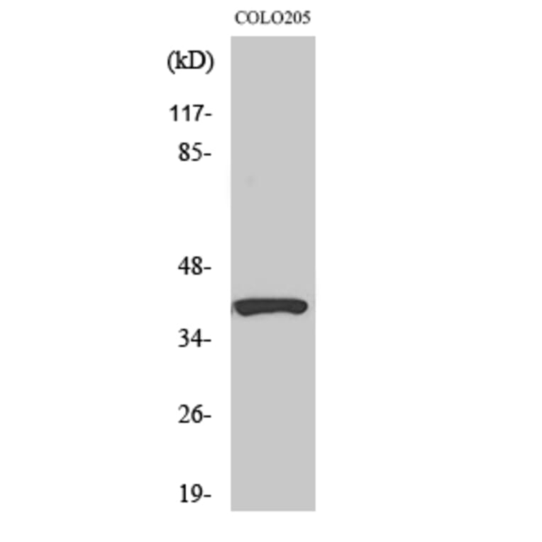 Western blot - PI-9 Polyclonal Antibody from Signalway Antibody (41341) - Antibodies.com